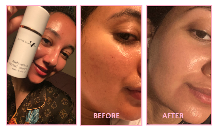Dr Vanita Rattan Antioxidant Power Serum 30ml before and after