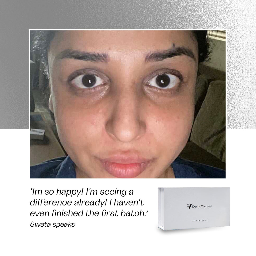Dr V Dark Circles Kit product review
