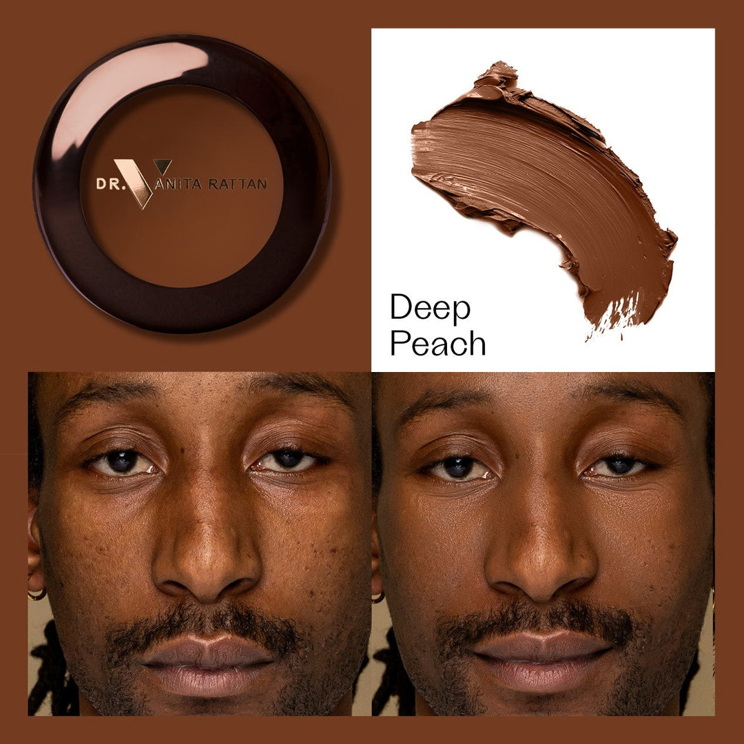 Dr. V Concealer - Deep Peach - make-up