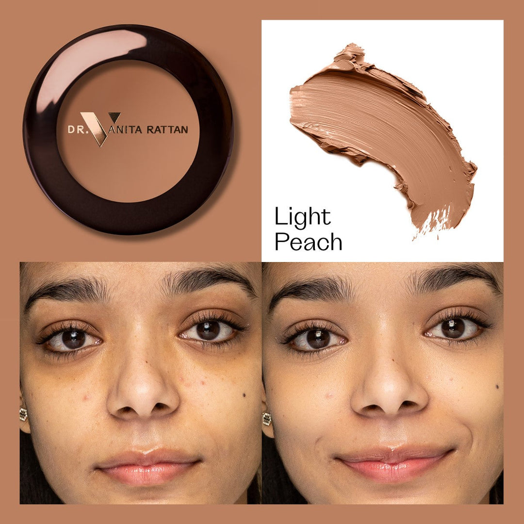 Dr. V Concealer - Light Peach - make-up