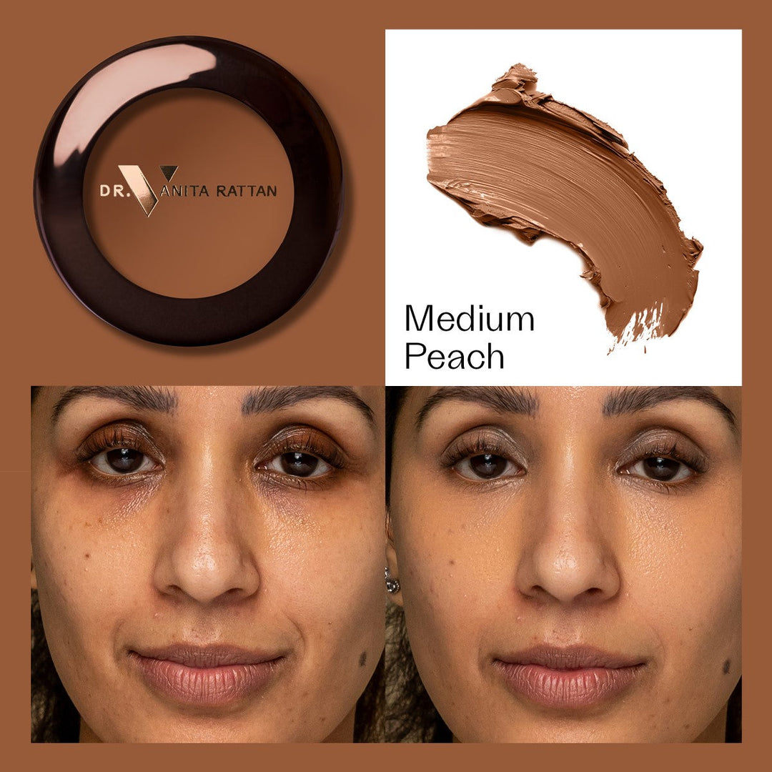Dr. V Concealer - Medium Peach - make-up