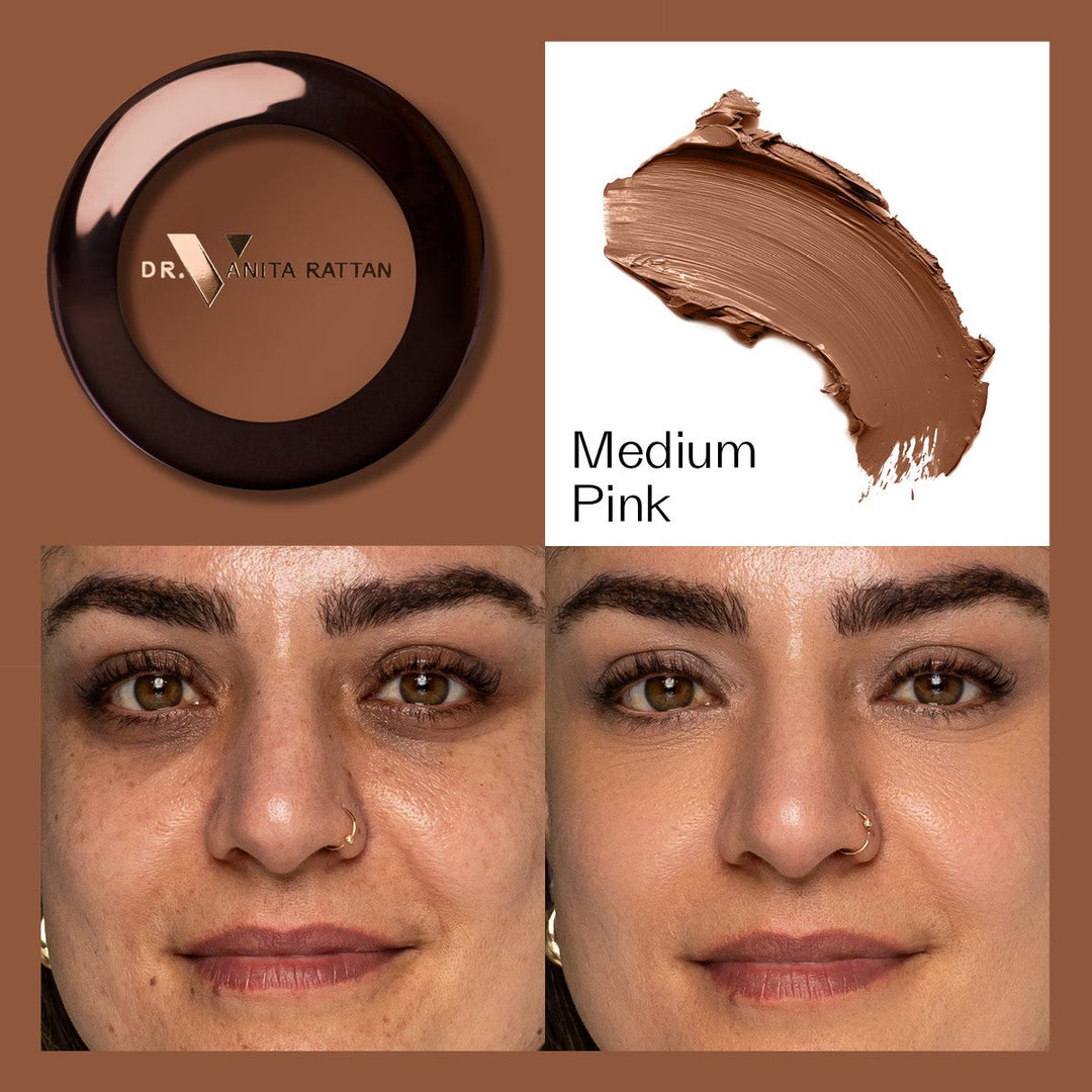 Dr. V Concealer - Medium Pink - make-up