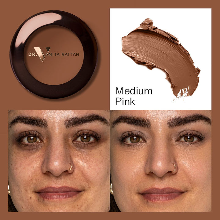 Dr. V Concealer - Medium Pink - make-up