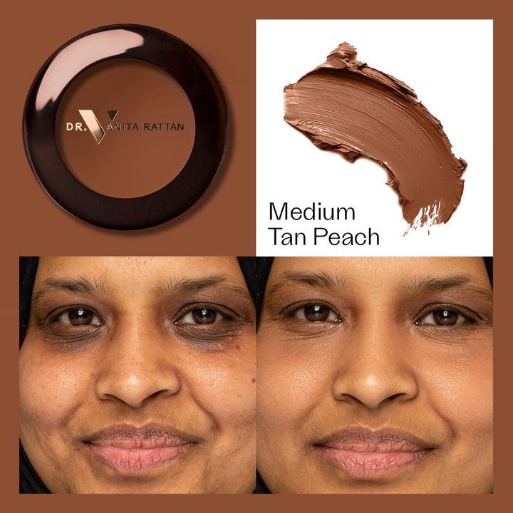 Dr. V Concealer - Medium Tan Peach - make-up