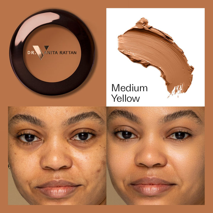 Dr. V Concealer - Medium Yellow - make-up
