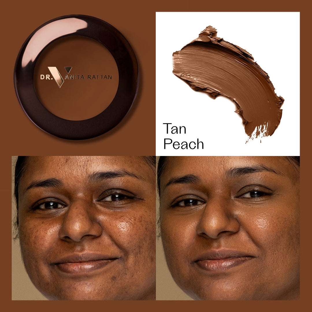 Dr. V Concealer - Tan Peach - make-up