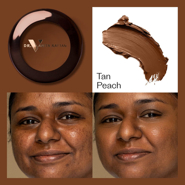 Dr. V Concealer - Tan Peach - make-up