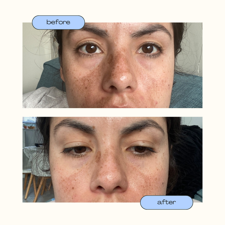 Facial Pigmentation Kit