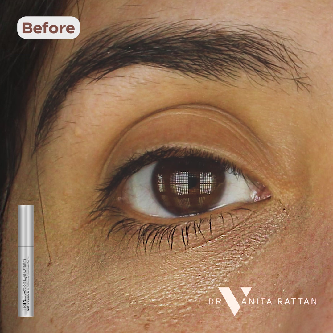 BA_TripleActionEyeCream_1 slider