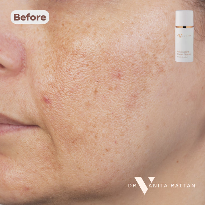 Before & After AntioxidantPowerSerum SLIDER
