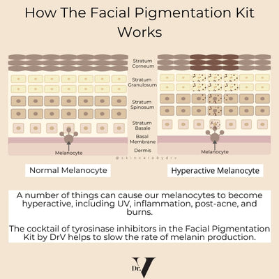 Facial Pigmentation Kit