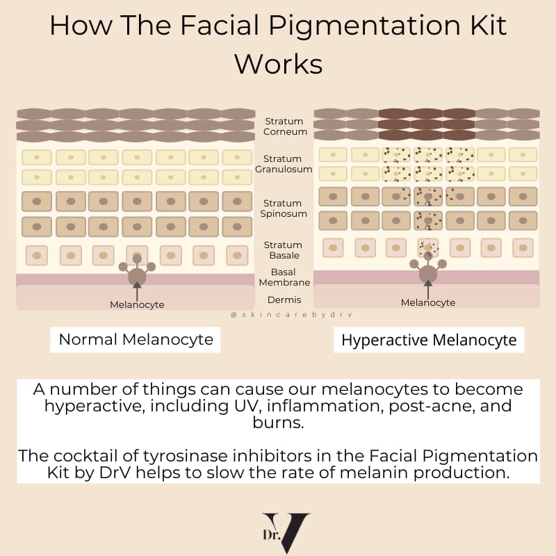 Kit Hyperpigmentation Dr V Facial Pigmentation Kit - Hyperpigmentation Treatment | Brown ...