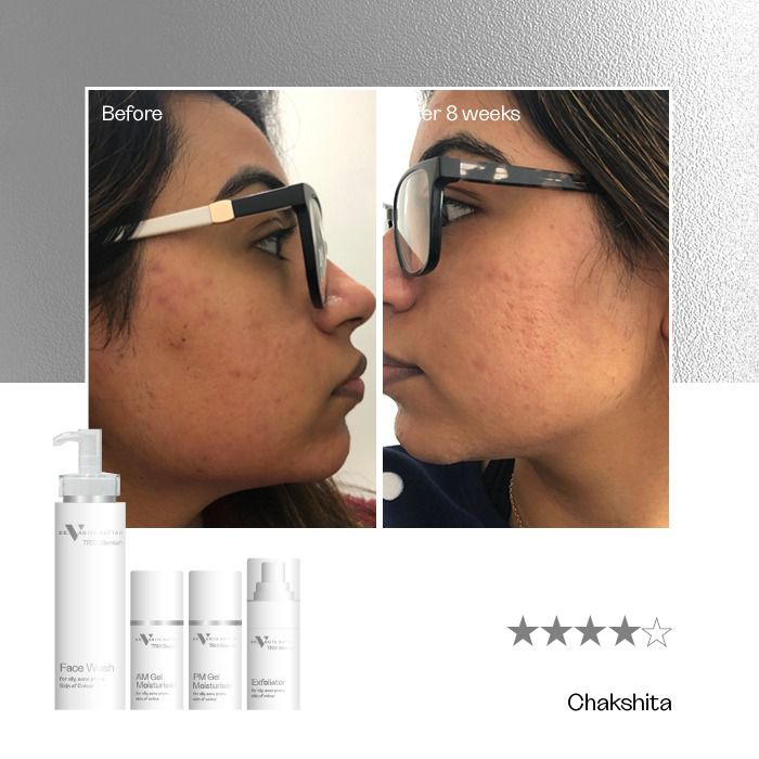 TRIO Blemish Complete Range